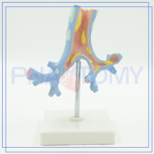 PNT-0751 trachea bronchi and pulmonary model for sale